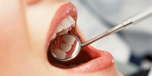 woman doing dental care